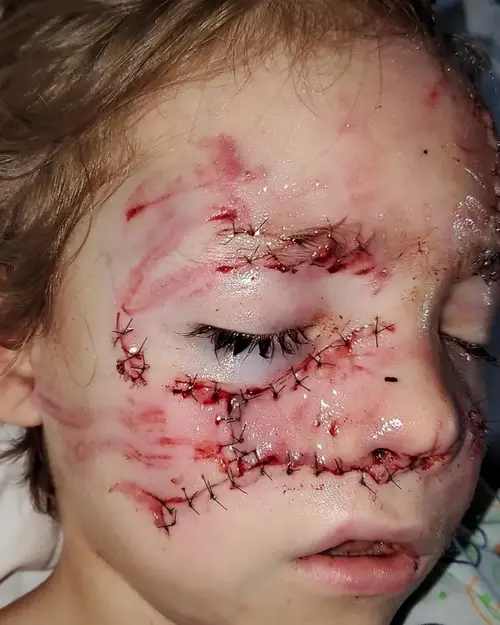 Bernardo sempre protegeu a família desde os 6 anos