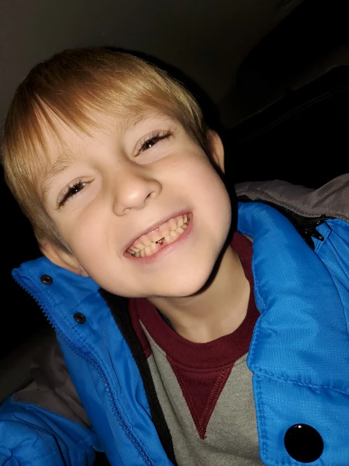 Bernardo protegeu a irmã e foi atacado no rosto